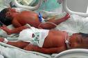 els bebes malnacits
